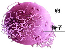 免疫性不孕