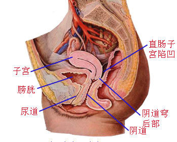 宝鸡妇科专家详解如何治疗盆腔脓肿