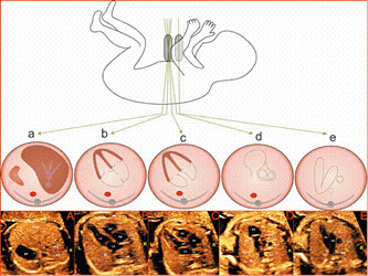 胎儿超声心动图_宝鸡华济妇科医院