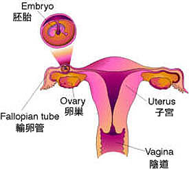 专家提醒：怀孕肚疼小心是宫外孕