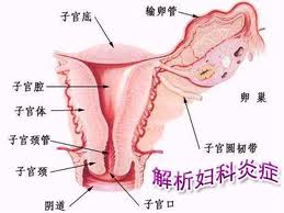 输卵管积水能治疗吗